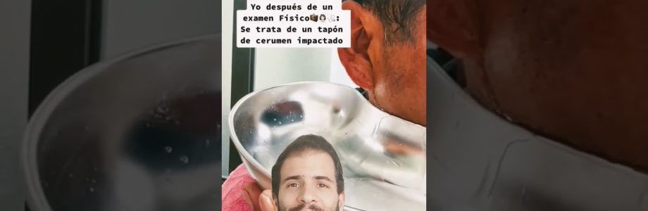 extracción de tapones compactos